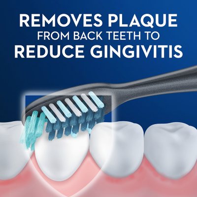 Oral-B Prohealth Advanced Manual Soft Toothbrush, 8 Ct.