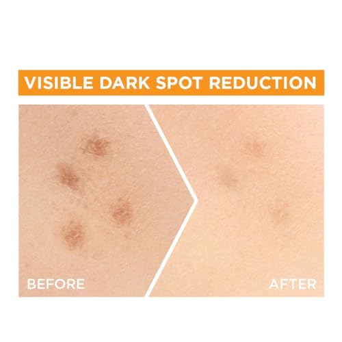 Garnier Skin Naturals, Face Serum, Increases Skin's  Glow Instantly and Reduces Spots Overtime, Bright Complete Vitamin C Booster, 30 ml