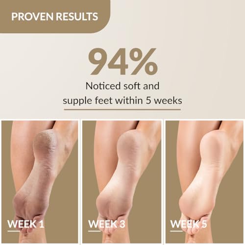 Fixderma Foobetik Cream, Foot cream, Foot Care For Diabetic, For Dry & Cracked Feet, Moisturizes & Soothes Feet, Heel Repair, For Calloused, or Chapped Skin, Paraben Free - 50g