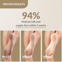 Fixderma Foobetik Cream, Foot cream, Foot Care For Diabetic, For Dry & Cracked Feet, Moisturizes & Soothes Feet, Heel Repair, For Calloused, or Chapped Skin, Paraben Free - 50g