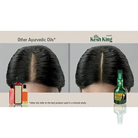 Kesh King Ayurvedic Oil for Hair Fall Control | Reduces Hairfall and Supports New Hair Growth | 21 Ayurvedic Herbs | 300ml