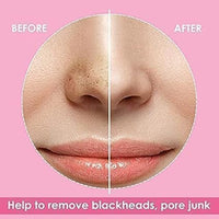 Luxenwell Deep Purifying Nose Strips for Women & Men | Enriched with Bamboo Charcoal | For Instant And Painless Blackheads And Whiteheads Removal (Pack of 10)