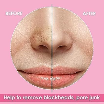 Luxenwell Deep Purifying Nose Strips for Women & Men | Enriched with Bamboo Charcoal | For Instant And Painless Blackheads And Whiteheads Removal (Pack of 20)