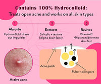 Urban Yog Acne Pimple Patch - Invisible Facial Stickers Cover With 100% Hydrocolloid, Pimple / Acne Absorbing Patch (Rectangular Pimple Patch) - Pack Of 1