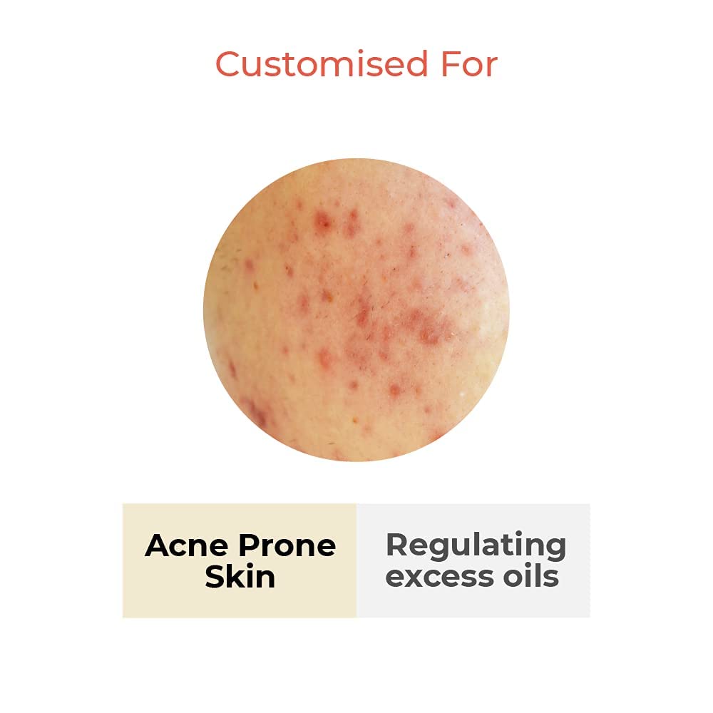 Vedix Customized Ayurvedic Toner | Vaimal One Step Clarifying Facial Toner With Tea Tree And Salicylic Acid | For Acne Prone Skin | For Pore Tightening and Moisturizing |100ml