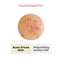 Vedix Customized Ayurvedic Toner | Vaimal One Step Clarifying Facial Toner With Tea Tree And Salicylic Acid | For Acne Prone Skin | For Pore Tightening and Moisturizing |100ml