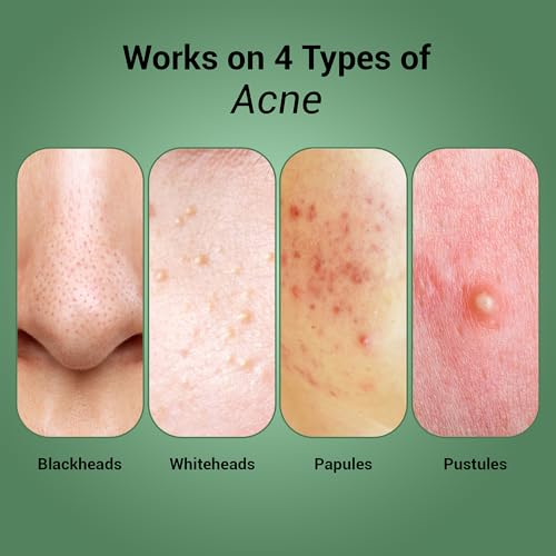 Sereko Pore Clearing Face Wash with 1% Salicylic Acid & Lactic Acid | Foaming Cleanser for Oily & Acne-Prone Skin | Deep Cleansing & Gentle Exfoliation | Sulfate-Free | For Men & Women | 100ml