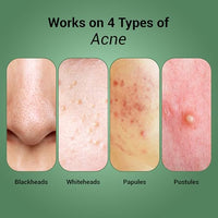 Sereko Pore Clearing Face Wash with 1% Salicylic Acid & Lactic Acid | Foaming Cleanser for Oily & Acne-Prone Skin | Deep Cleansing & Gentle Exfoliation | Sulfate-Free | For Men & Women | 100ml