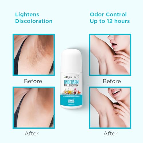 Orgatre Underarm Roll On Serum for Dark Underarms | Prevents Body Odour, Brightens Skin & Exfoliates | Fades Pigmentation, Kills Bacteria | AHA + Kojic Acid + Lactic Acid | 50ml | Unisex