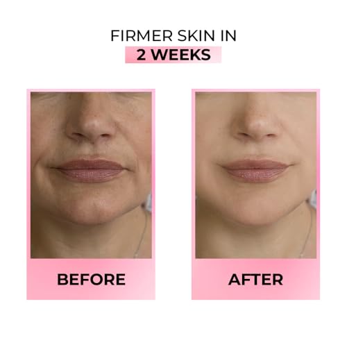 Streax Youthful Shine Face Serum, 30ml | 11% Retinol| Anti- Ageing|Serum for Pigmentation and Dark Spot|Niacinamide serum,Reduces Dark Spots, Blemishes, Patchy Skin & Wrinkles for a Youthful Glow