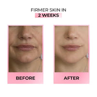 Streax Youthful Shine Face Serum, 30ml | 11% Retinol| Anti- Ageing|Serum for Pigmentation and Dark Spot|Niacinamide serum,Reduces Dark Spots, Blemishes, Patchy Skin & Wrinkles for a Youthful Glow