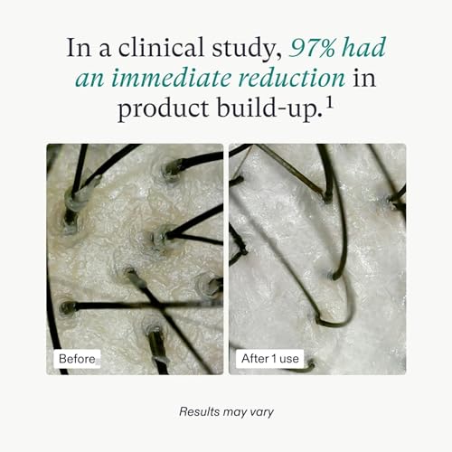 Ravel Anti-Dandruff Hair Serum for Scalp | Eliminates Dandruff & Itchiness | With 2% Dandelix Pro & 1.5% Defensescalp | Soothes & Balances Scalp | Dandruff Remover | For Men & Women | 100ml