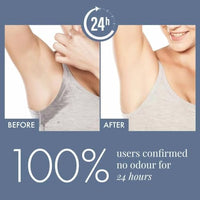 ThriveCo Underarm Brightening Roll-On with 5% AHA BHA, Tranexamic Acid & Retinol – 48H Odour Control, Brightens Underarms & Reduces Discolouration for Smooth & Even Skin, For Men & Women, 40 ml