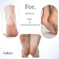 20% Urea Foot Cream Roll On With Salicylic Acid, Lactic Acid, Olive Oil | Foot Cream Moisturizer for Dry Cracked Feet | Repair and Moisturise Cracked Heels | Hydrates & Nourish Foot Care for Softens Skin | For Women & Men | (50ML * pack 2)