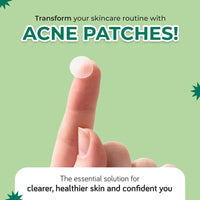 Moody Acnexpert Pimple Patches For Face With Salicylic Acid (0.5%), Hydrocolloid & Green Tea | Hydrocolloid Patch | Acne Removal |Acne Pimple Patch | Invisible Facial Stickers |Pimple Remover | Reduces Acne, (36 nos)
