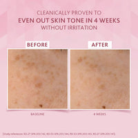 Cetaphil Brightening Day Protection Cream SPF 15-50 g| Day Cream for Dark Spots, Uneven Skin Tone| Niacinamide, Sea Daffodil| Fragrance-Free|