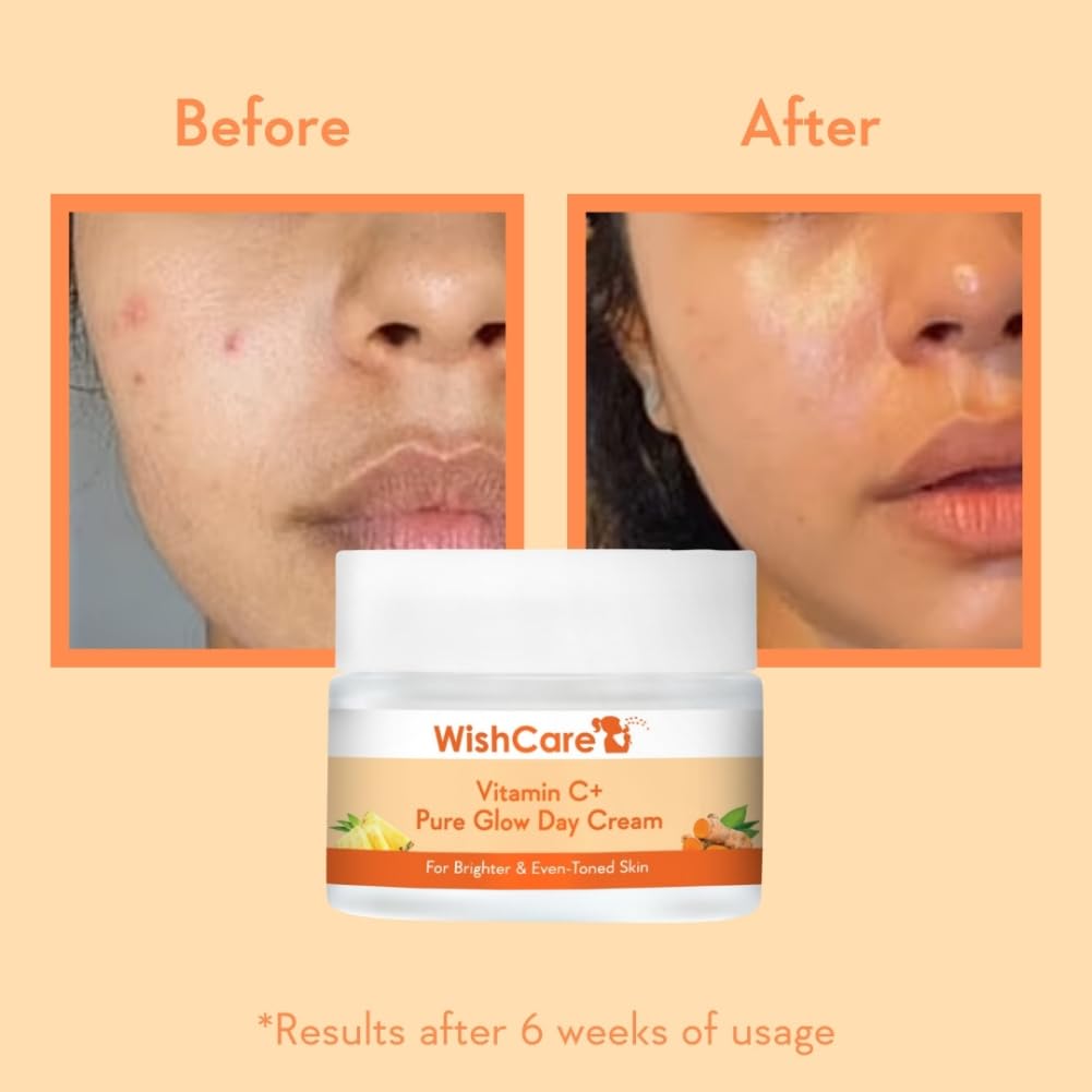 WishCare Pure Glow Vitamin C Face Cream for Women & Men - Day & Night Cream - For Glowing, Bright, Young and Pigmentation Removal - With Hyaluronic Acid, Niacinamide, Oranges, Berries & Turmeric-50 gm (PGFC50)