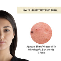 Vedix Anudha Glow Restore Moisturizing Face Lotion For Oily Skin With Bakuchi, Manjishta and Lodhra l Customized Ayurvedic Face Moisturizer - 40 ml