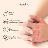 VEDICDERM Oleander Psoriasis Skin Care Oil Natural, Steroid-Free Formula for Dry, Itchy, and Flaky Skin Helps Soothe Irritation, Redness, & Promote Hydration, Suitable for Daily Use (200ml Pack of 1)