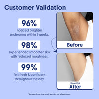 Aravi Organic Cooling Underarm Roll-On | 5% AHA, 2% Kojic Acid & 1% Mandelic Acid | Controls Odour & Sweat | Reduces Pigmentation & Exfoliates | Alcohol-Free & Aluminium-Free | Fresh Aqua Fragrance | 50ml