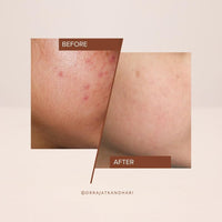 The Facecraft Project Gentle Face Exfoliate | Hydrating Ingredients | No Dryness | Daily Skin Care Essential | (10ml)