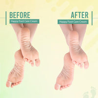 Glamveda Happy Foot Care Crack Cream For Moisturizes | Suitable for Dry & Cracked Foot Skin 100g Pack of 1