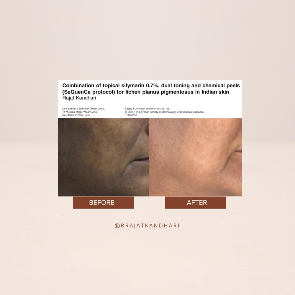 THE FACECRAFT PROJECT Retinol Night Cream | Hydrating & Nourishing Formula |Hyaluronic Acid Blend | Smooth & Supple Skin |Lightweight Texture | Restorative Skincare | Daily Night Routine (15gm)