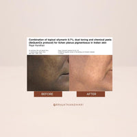 THE FACECRAFT PROJECT Retinol Night Cream | Hydrating & Nourishing Formula |Hyaluronic Acid Blend | Smooth & Supple Skin |Lightweight Texture | Restorative Skincare | Daily Night Routine (15gm)