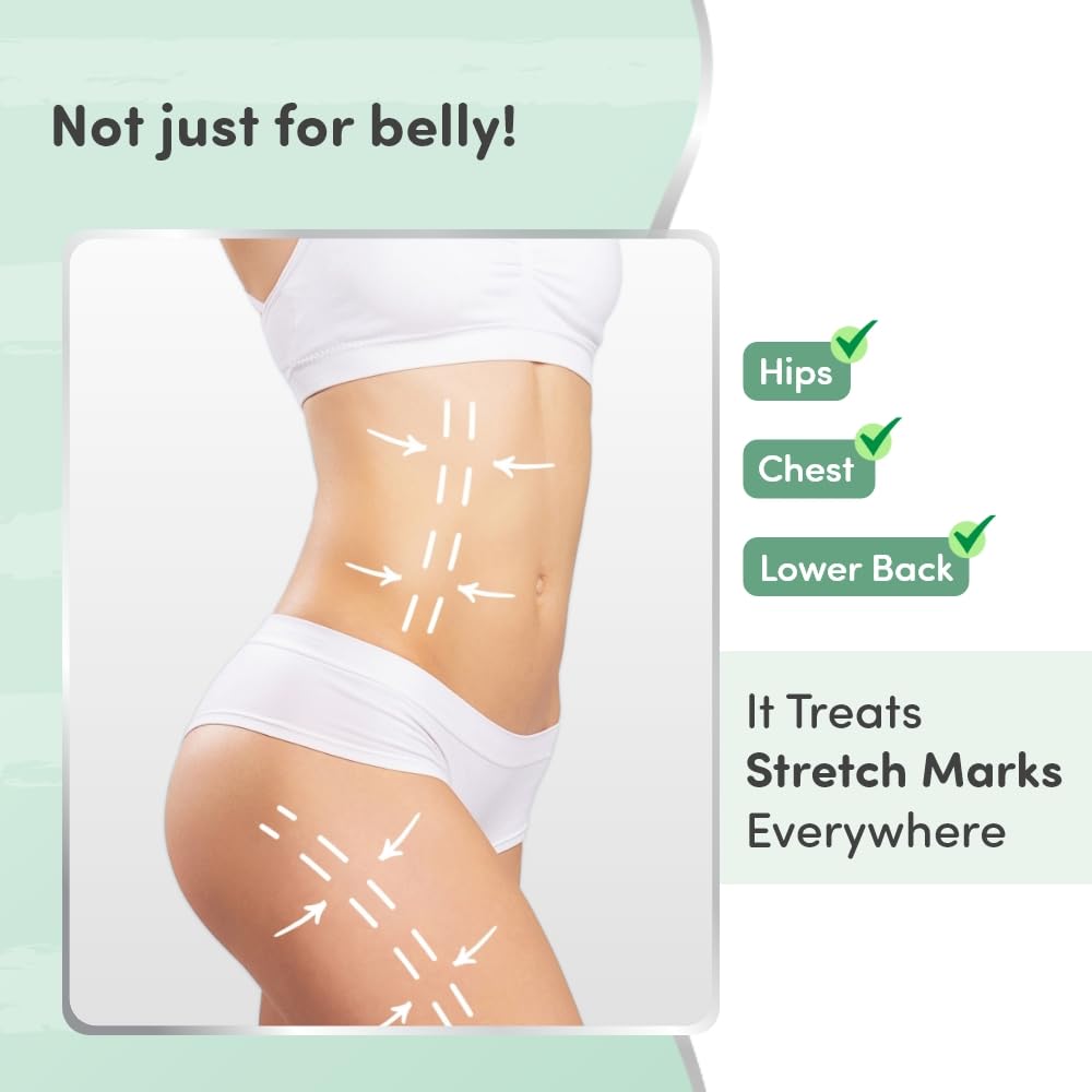 Mylo Stretch Marks Oil 100ml, for Scars & Stretch Mark Lightening - Natural Skin Care Solution for Pregnant Women