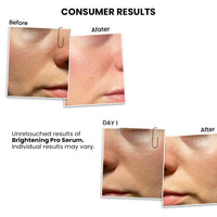 ThriveCo Skin Brightening PRO Serum For Women with Probiotic Rice Water, Vit C, Kojic Acid, Alpha Arbutin & Glutathione | Anti-ageing, Boosts Collagen, Clears Skin & Removes Dark Spots | 30ml