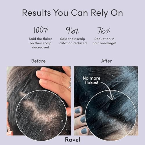 Ravel Anti-Dandruff Hair Serum for Scalp | Eliminates Dandruff & Itchiness | With 2% Dandelix Pro & 1.5% Defensescalp | Soothes & Balances Scalp | Dandruff Remover | For Men & Women | 100ml