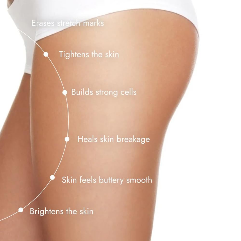 Cos-IQ Stretch Mark Removal Roll-On Serum 80ml | with Striover | Scar Removal | Uneven Skin Tone | All Skin Types | 60 Days Pack