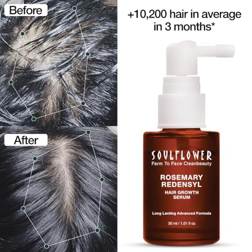Soulflower Hair Growth Redensyl Tetragain Serum, Rosemary Oil, 3% Redensyl, 4% Anagain, Caffeine, Melanogray, Biotin, Rice Water, Anti Hair fall, Clinically Tested on Real people, Men & Women, 30ml