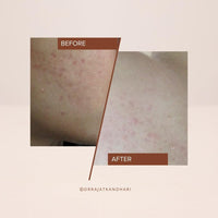 THE FACECRAFT PROJECT Cleanser|Moisture-Rich | entle Gel Face Cleanser | Soap-Free |Deep Hydration Dual-Use Mask |Removes Impurities |Balances Sebum |Soft & Supple Skin |Daily Skincare Routine (25ml)