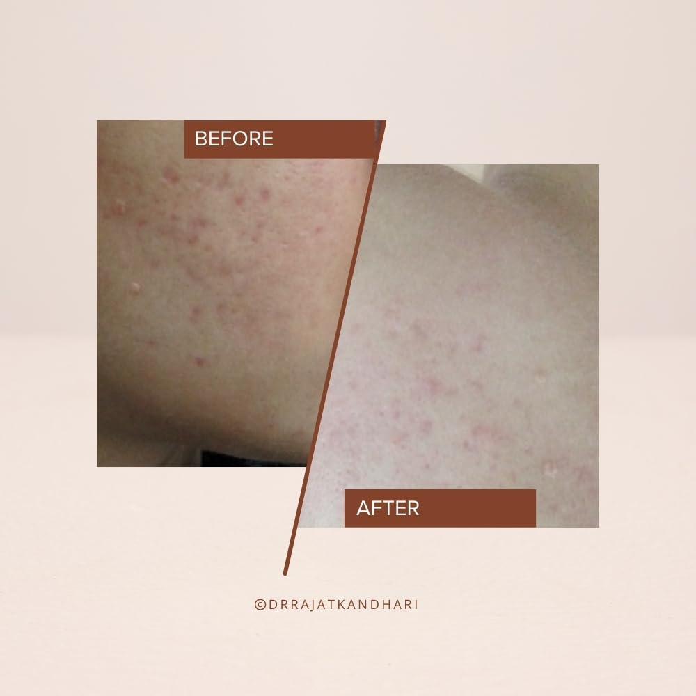 THE FACECRAFT PROJECT Cleanser|Moisture-Rich |Gentle Gel Face Cleanser |Soap-Free |Deep Hydration |Dual-Use Mask |Removes Impurities |Balances Sebum |Soft & Supple Skin |Daily Skincare Routine (150ml)