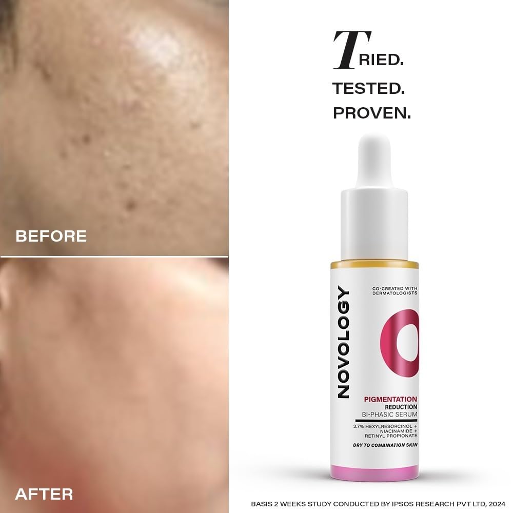 Novology Bi-Phasic Serum for Hyperpigmentation, Dark Spots, Acne Marks and Uneven Skin Tone| Dry-Combination Skin | 28ml (Pack of 2)