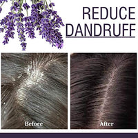 Old Tree Lavender Essential Oil for Home Fragrance (15ml) - Pure & Natural Lavender Oil for Skin, Hair growth, Sleep, Diffuser, Soap Making - Essential Oil with Dropper for Aromatherapy and Relaxation