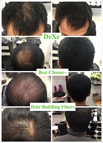Dexe Classic Necessity Easy to Use Lose Hair Building Fibres 22g, Black
