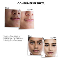 ThriveCo Brightening PRO Cleanser for Women with Probiotic Rice Water, Vit C, Kojic Acid, Alpha Arbutin & Glutathione | Anti-ageing Face Wash, Boosts Collagen, Clears Skin & Removes Dark Spots | 100ml