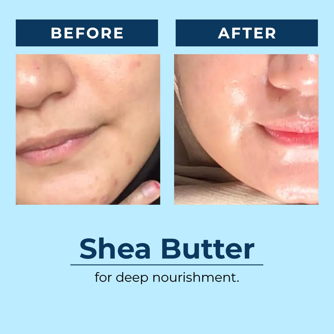 AQUAVE HydraI™ Algae Moisturizer for Face | 2% Niacinamide + Marine Actives | 72H Intense Hydration & Skin Barrier Repair | For Dry, Normal & Combo Skin | Brightens & Softens in 30 Days | Unisex