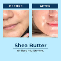 AQUAVE HydraI™ Algae Moisturizer for Face | 2% Niacinamide + Marine Actives | 72H Intense Hydration & Skin Barrier Repair | For Dry, Normal & Combo Skin | Brightens & Softens in 30 Days | Unisex