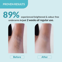 Fixderma Nigrifix Underarm Ocean Roll on With 6% AHA, Lactic Acid & 1% Mandelic Acid & Kojic Acid | Brightens Skin & Exfoliates Underarm | For Sensitive Skin - 60ml (Pack of 1)