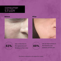 Deconstruct 0.2% Retinol Face Serum With 1% Peptide | Beginner Friendly | Anti Aging, Night Face Serum To Reduce Fine Lines & Wrinkles | For Men & Women | Beginner Friendly | 30 Ml