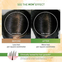 WOW Skin Science Skin Science Rosemary & Biotin Hair Growth Shampoo | Fights Hair Fall | Grows New Hair | Prevents Breakage & Split Ends | Adds Shine To Dull Hair, 250 Gram (Pack of 2)