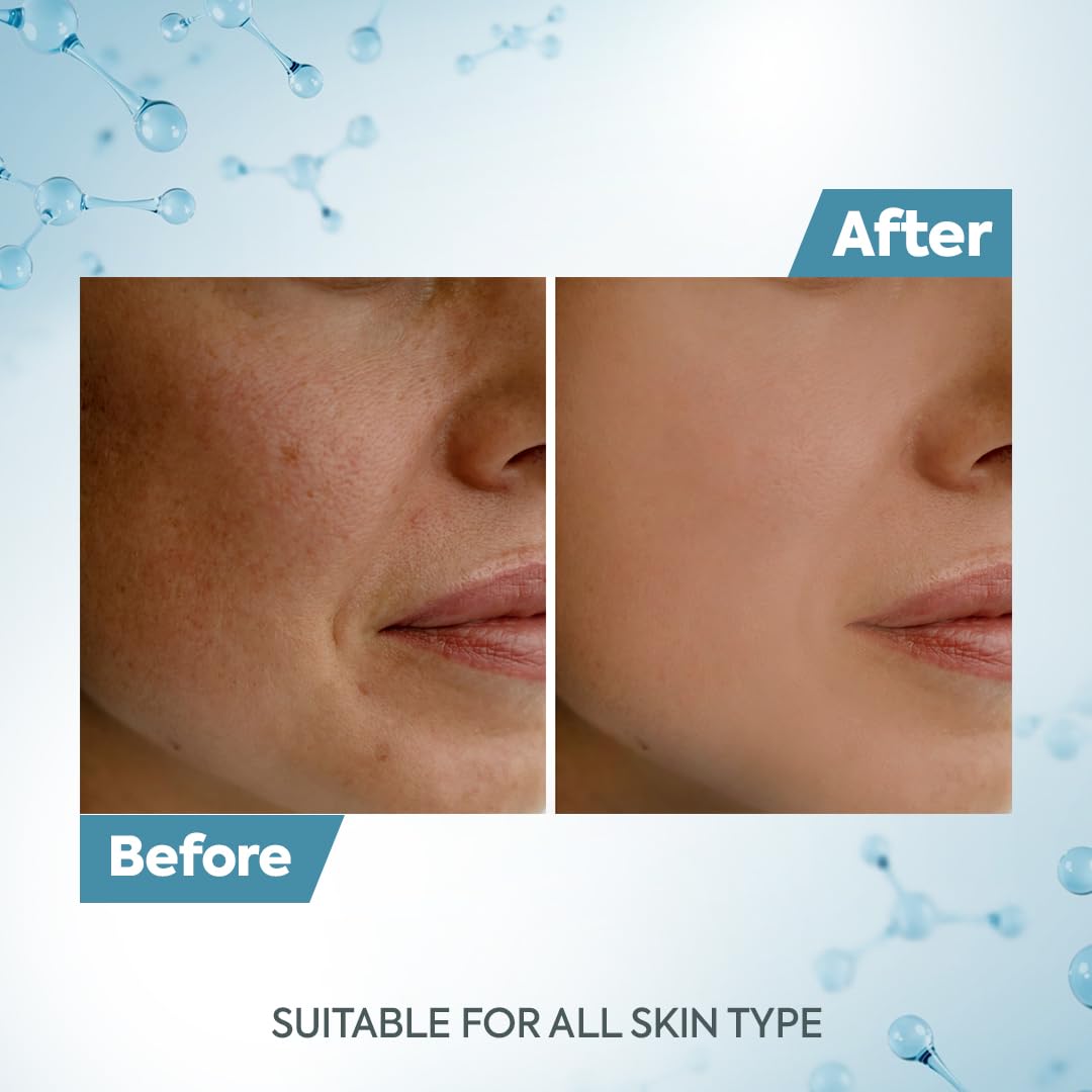 Raaga Professional De-Tan Pack with Kojic, Lactic Acid & Arbutin | Tan Removal Cream | Dermatologically Tested, Peroxide, Hydroquinone & Sulphate Free- 12g x 6 (72gm)