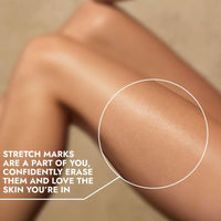 Cos-IQ Stretch Marks Removal Roll-On Serum with Striover | Scar Removal | Uneven Skin Tone | All Skin Types | 40ml