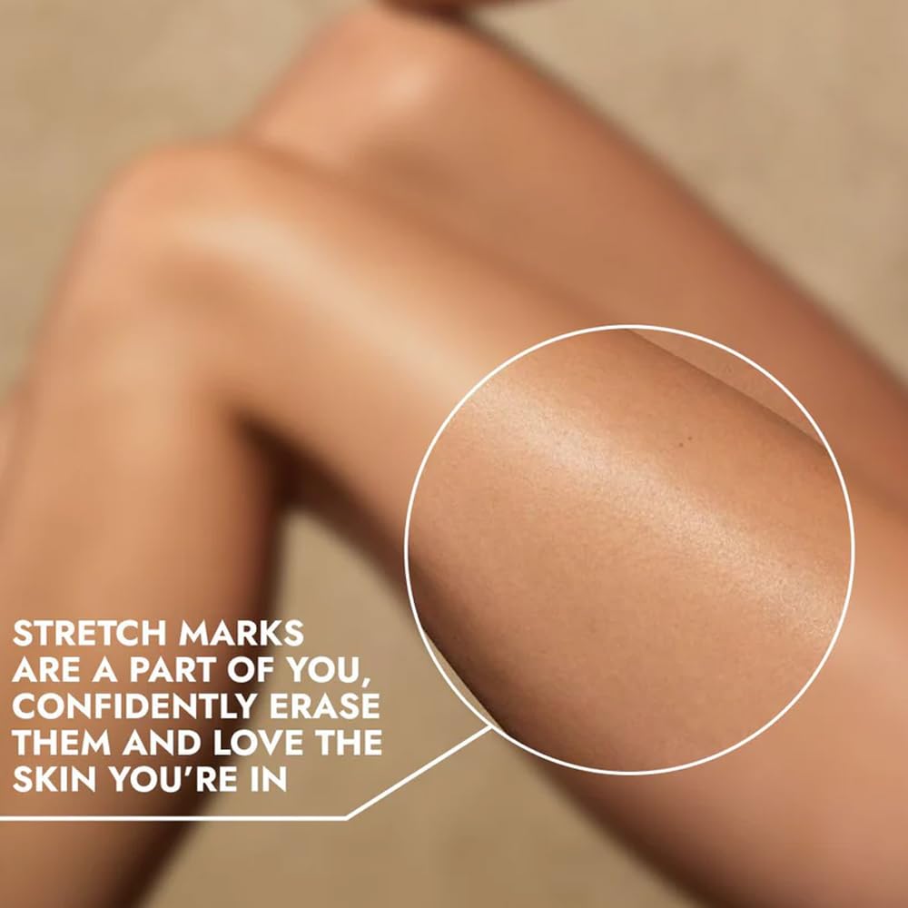 Cos-IQ Stretch Mark Removal Roll-On Serum 80ml | with Striover | Scar Removal | Uneven Skin Tone | All Skin Types | 60 Days Pack