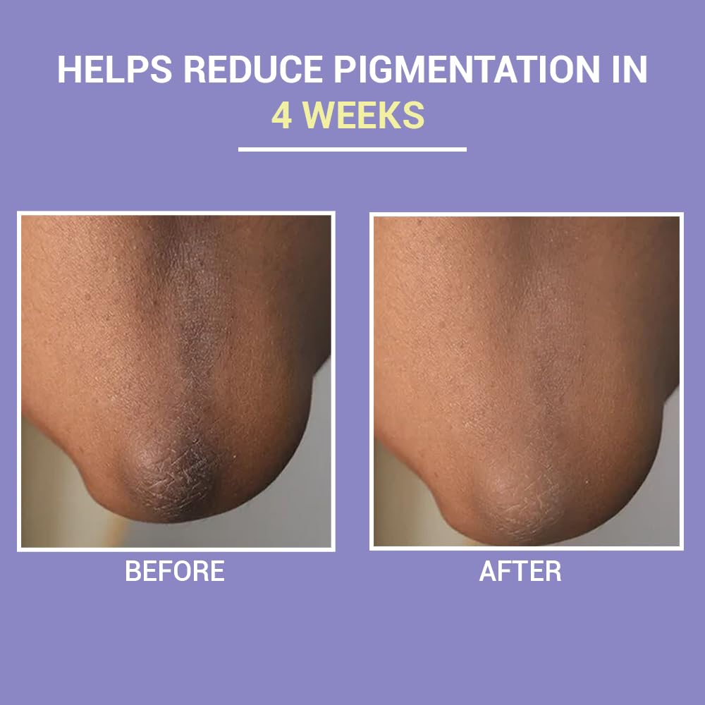 SEREKO Clarifying Gentle Exfoliation Body Scrub made with Fine textured Bath salts, Psycodermatology Formula, Vitamin C and Epsom salts, Skin Brightening Formula & Removes Dead Skin. 100g