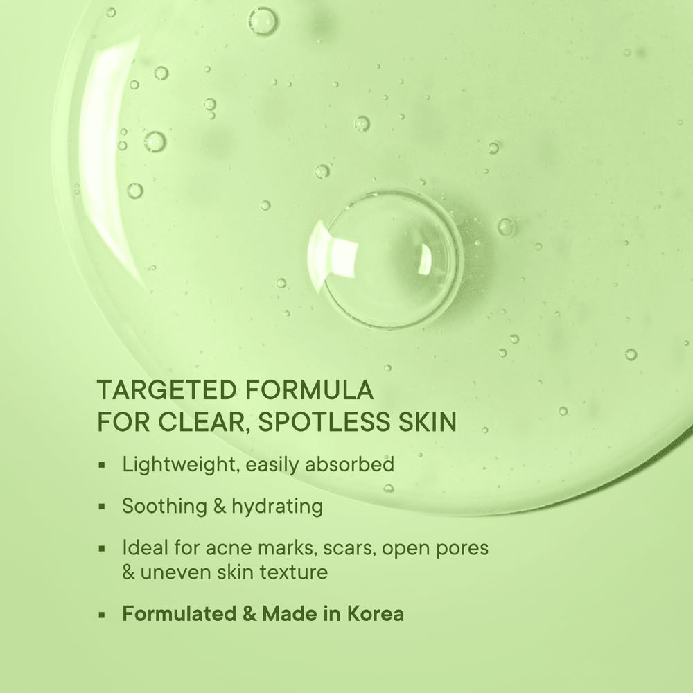 Quench Clear Skin Serum With Matcha Green Tea, Niacinamide & Hyaluronic Acid | Controls Oil Production | Fades Dark Spots, Acne Marks & Pigmentation | Made In Korea 30Ml)