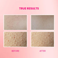 Suroskie Velvet Glaze Exfoliating Glow 2 In 1 Body Scrub Wash | With Salicylic/Glycolic Extract & Niacinamide | For Body Acne, Tan Removal, Glowing Skin | Body Wash Shower Gel For Women & Men
